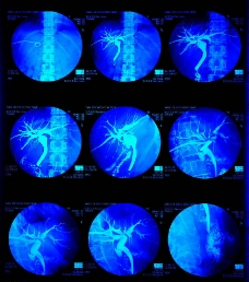 医疗卫生X光照片医疗科技卫生工作图片
