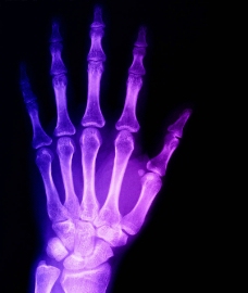 医疗卫生X光手骨医疗科技卫生图片